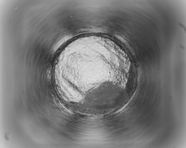 X0000099381163200805291122