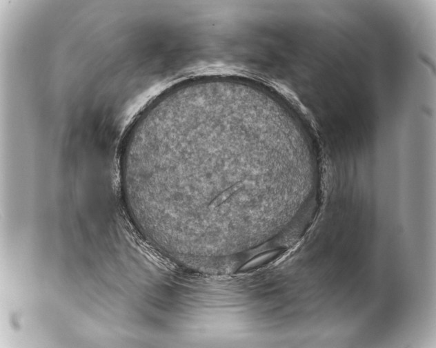 X0000099381167200805291122