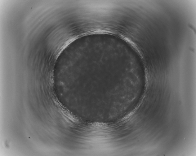 X0000099381170200805291122