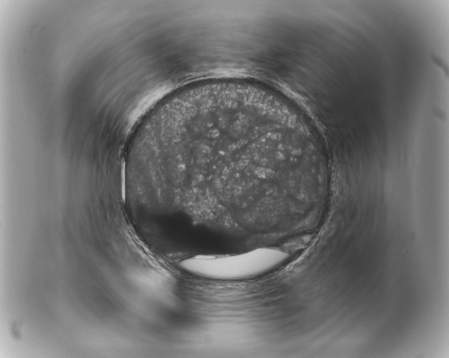 X0000099381171200805291122