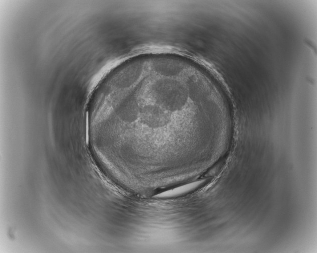 X0000099381175200805291122