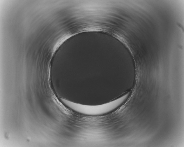 X0000099381179200805291122