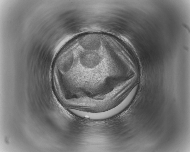 X0000099381183200805291122