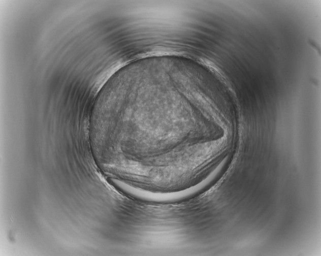 X0000099381185200805291122