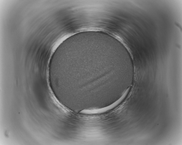 X0000099381187200805291122