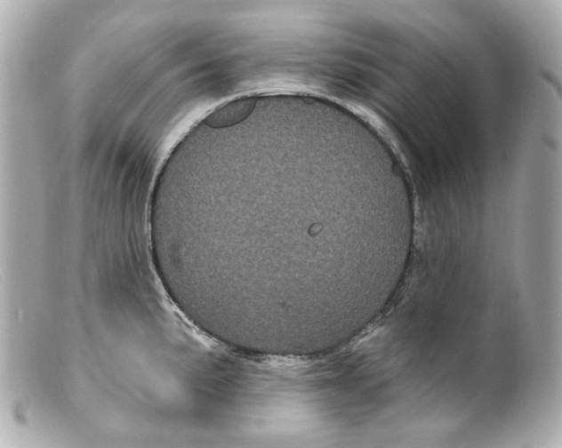 X0000099381191200805291122