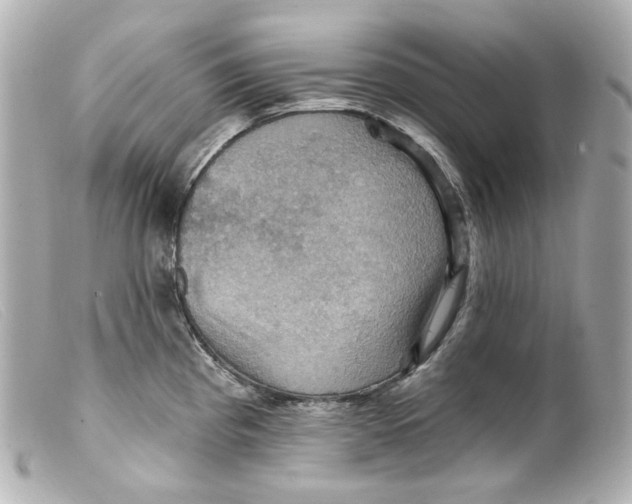 X0000099381193200805291122