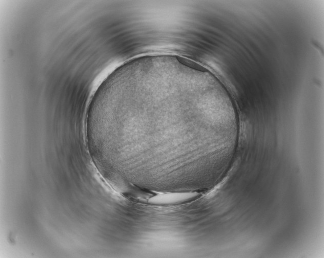 X0000099381196200805291122