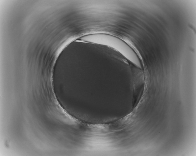 X0000099381197200805291122