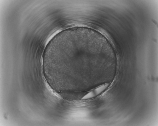 X0000099381198200805291122