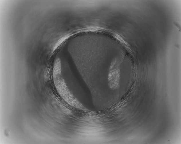 X0000099381208200805291121