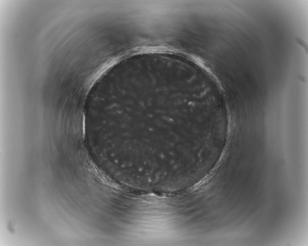 X0000099381221200805291121