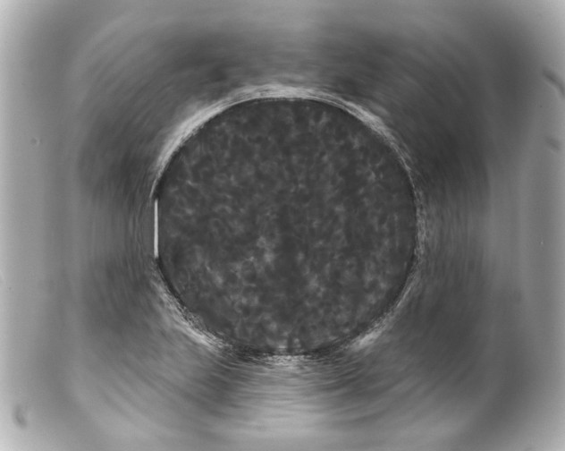 X0000099381223200805291121