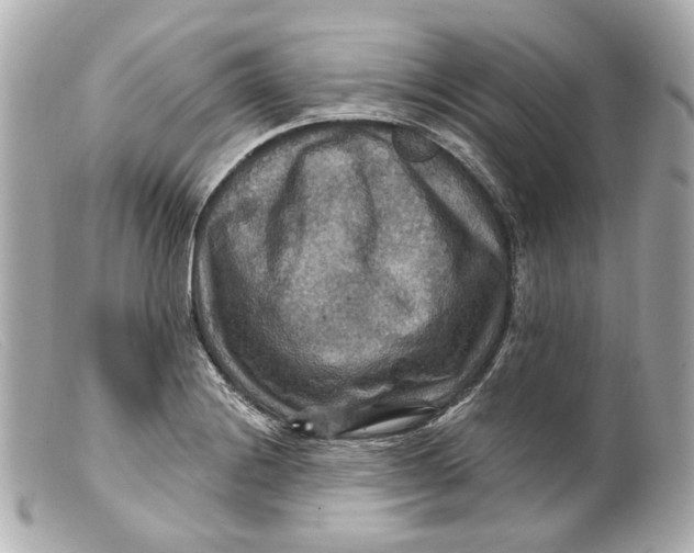 X0000099381228200805291121