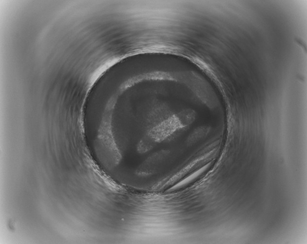 X0000099381230200805291122