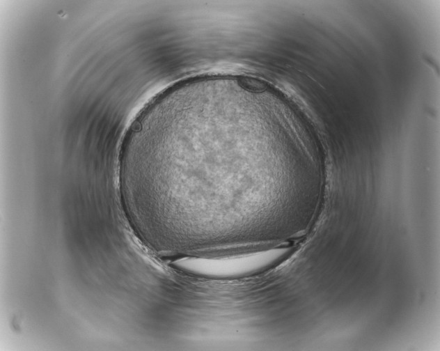 X0000099381232200805291122