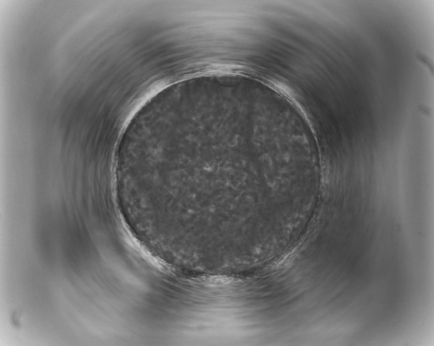 X0000099381235200805291122