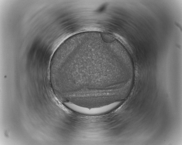 X0000099381236200805291122