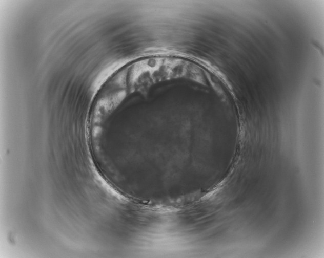 X0000099381239200805291122