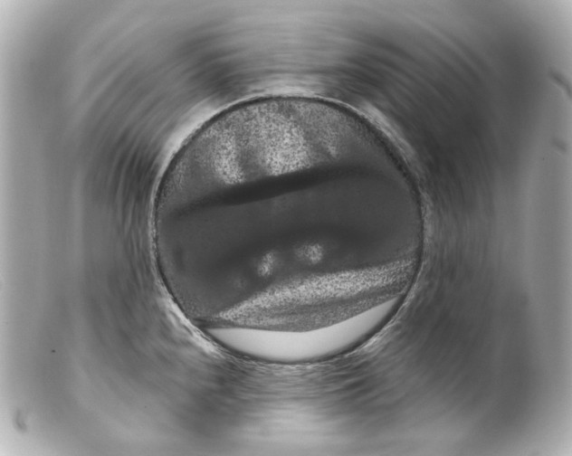 X0000099381240200805291122