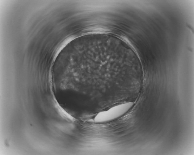 X0000099381243200805291122