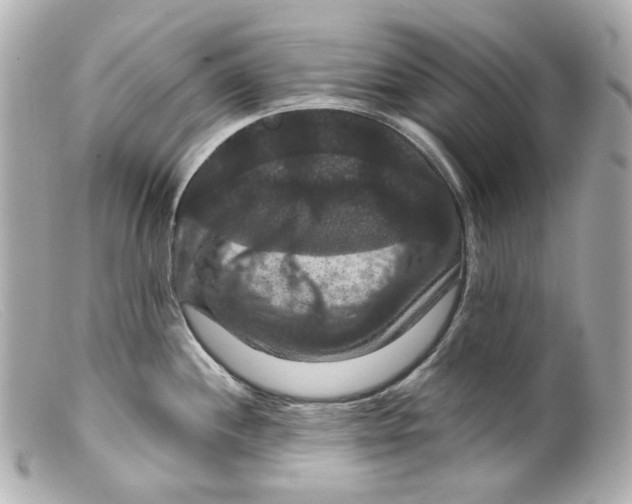 X0000099381244200805291122