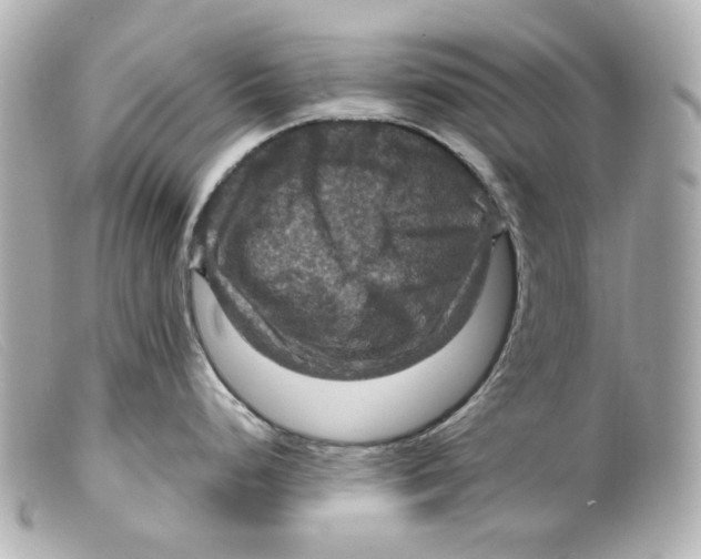 X0000099381248200805291122