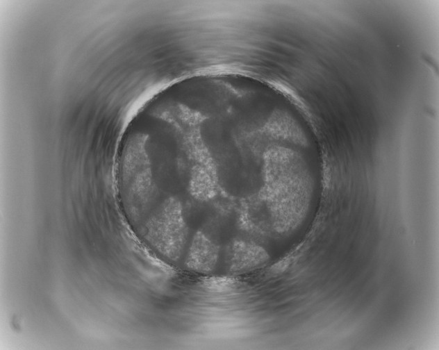 X0000099381278200805291121