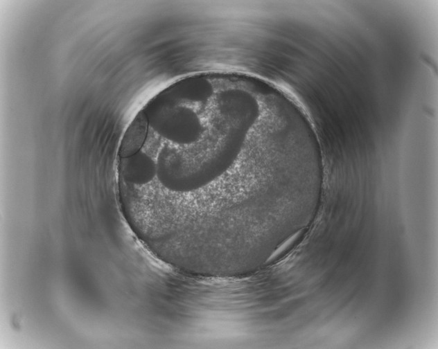 X0000099381287200805291121