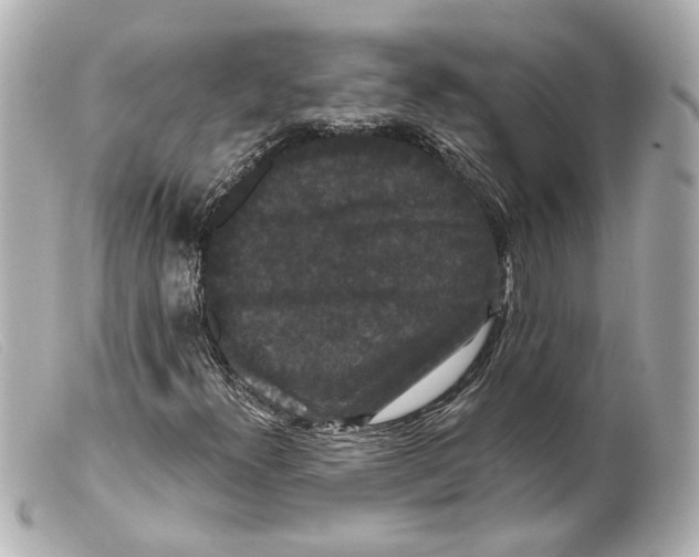 X0000099381300200805291120