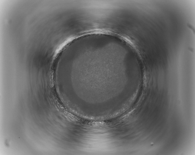 X0000099381310200805291120