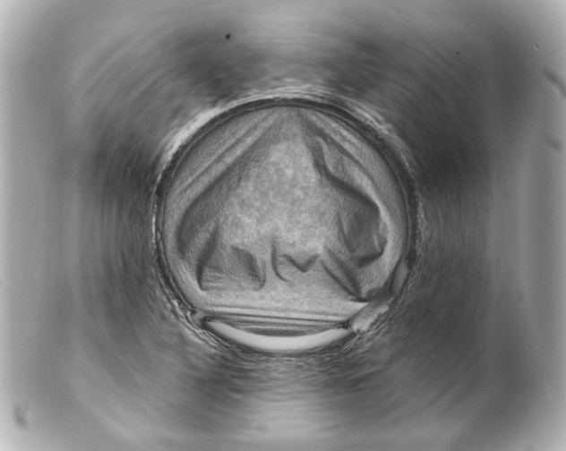 X0000099381316200805291120