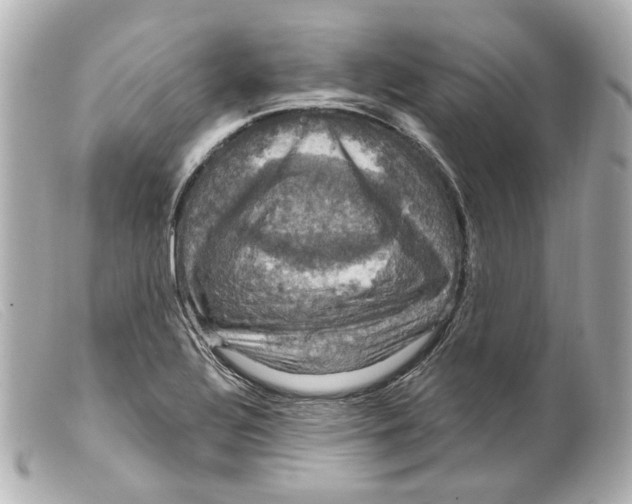 X0000099381320200805291120