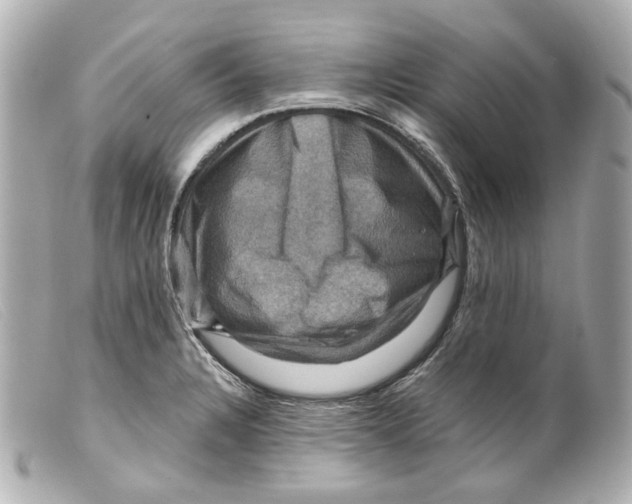 X0000099381328200805291120