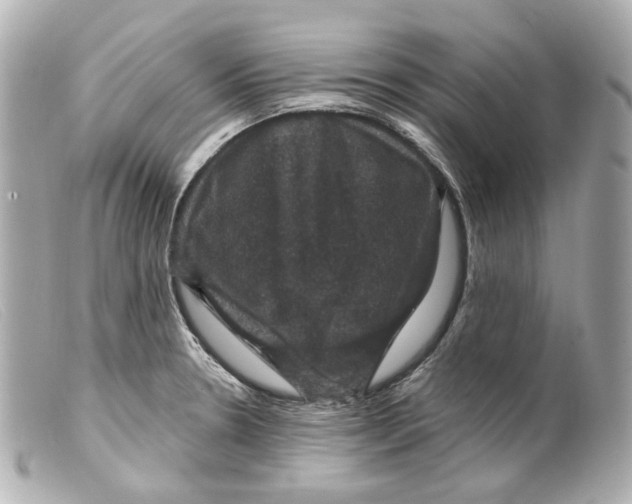 X0000099381330200805291120