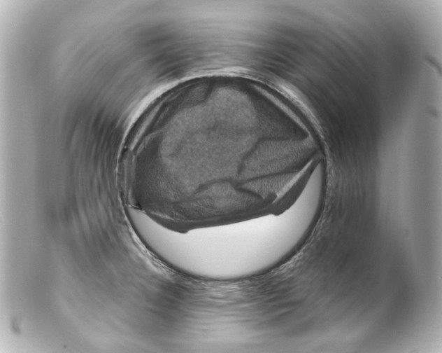 X0000099381332200805291120