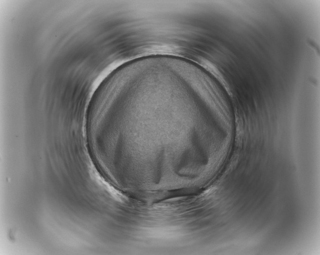 X0000099381339200805291120