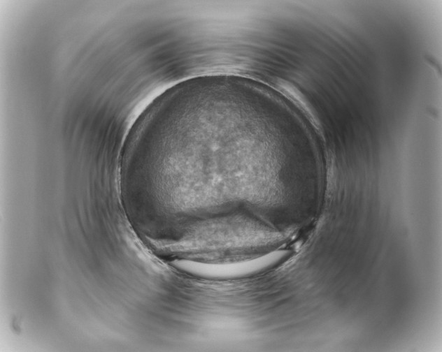 X0000099381340200805291120