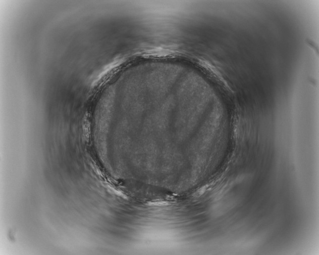 X0000099381350200805291120