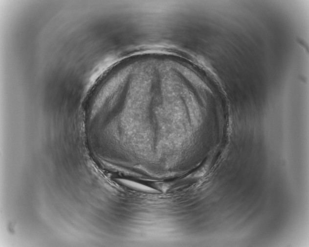 X0000099381360200805291120