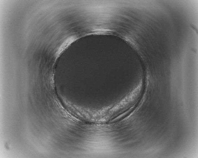 X0000099381362200805291120