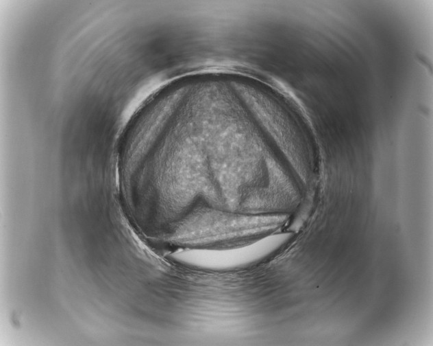 X0000099381368200805291120