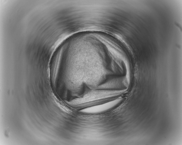 X0000099381372200805291120