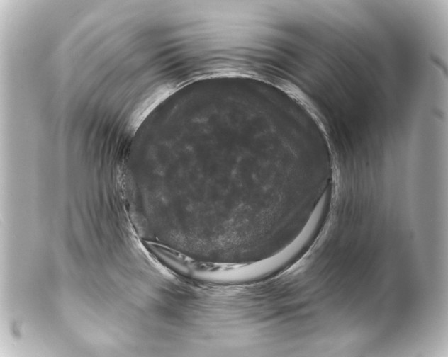 X0000099381385200805291119