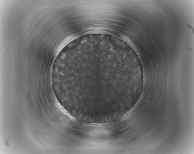 X0000099381386200805291119