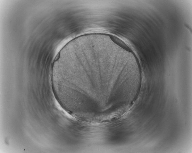 X0000099381390200805291119