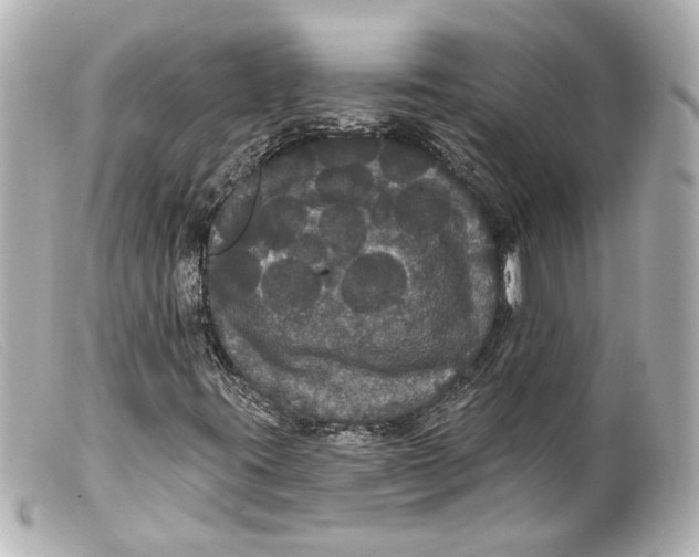 X0000099381395200805291119