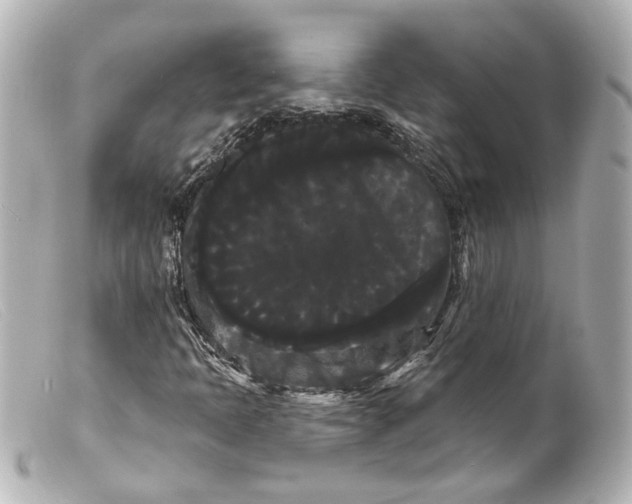 X0000099381397200805291119