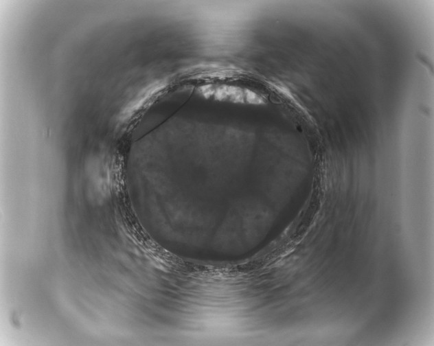 X0000099381399200805291119