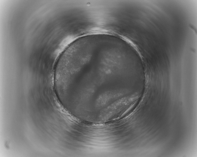 X0000099381415200805291119